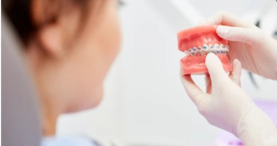 Dental benefits of MUFACE as well as Social Security Dental benefits of MUFACE as well as Social Security